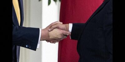 راز کبودی‌های عجیب روی دستان ترامپ فاش شد!
