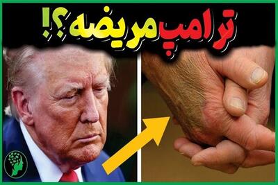 فوری | کاخ سفید تأیید کرد: ترامپ بیمار است | 27 تیر 1404