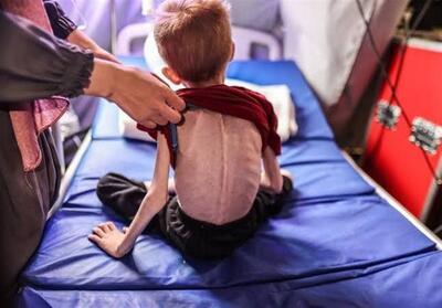 جنگ غزه| از هر 10 کودک، یک کودک در غزه دچار سوءتغذیه است - تسنیم