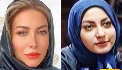 فریبا نادری: زندگی من به قبل و بعد از عمل بینی تقسیم میشه