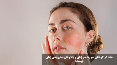 علت گر گرفتگی صورت در زنان و بالا رفتن دمای بدن زنان چیست؟