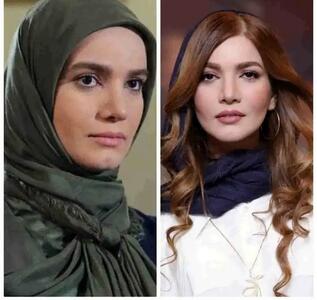 متین ستوده قبل و بعد از تزریقات زیبایی را ببینید/ تصاویر