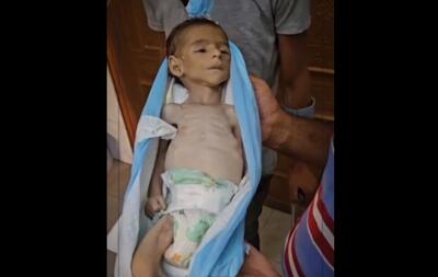 (۱۶+) تصاویر دلخراش از شهادت کودک بر اثر گرسنگی