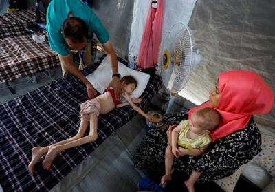 شهادت ۱۸ فلسطینی در غزه طی ۲۴ ساعت گذشته به دلیل گرسنگی