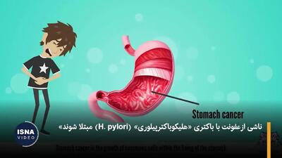 باکتری خطرناک معده: علت اصلی 12 میلیون سرطان + فیلم