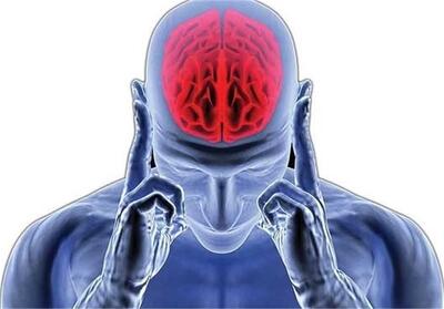 هر 7دقیقه یک ایرانی مبتلا به آلزایمر می‌شود/ ممنوعیت درمان‌ خانگی سکته مغزی - تسنیم