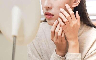 جوان نگه داشتن پوست صورت با مصرف این خوراکی