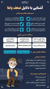آشنایی با دلایل ضعف پاها