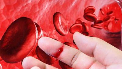 هموفیلی را بیشتر بشناسیم، از علائم تا کنترل بیماری