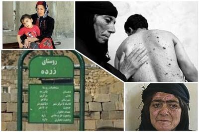 هیروشیمای ایران هنوز می‌سوزد؛ زرده، بایگانیِ دردهای خاموش
