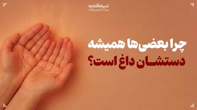 چرا دست‌هایتان همیشه داغ است؟