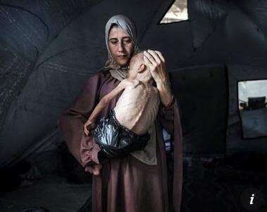 تصویر دردناک از یک کودک گرسنه در غزه