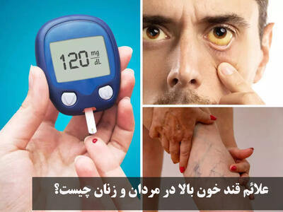 علائم قند خون بالا در مردان و زنان چیست؟ نشانه های قند خون بالا روی چهره و پوست