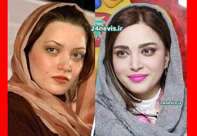 عکس/ تغییر شوکه کننده چهره بهنوش طباطبایی بعد از عمل زیبایی | اقتصاد24