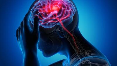 راهکارهای پیشگیری از سکته مغزی |  وضعیت خیم ایران در زمینه سکته مغزی