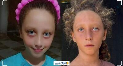 قبل و بعد از کودکان غزه +تصاویر | جهان نیوز