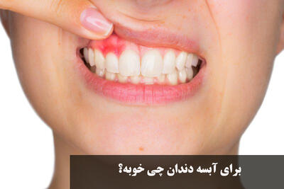 برای آبسه دندان چی خوبه؟ درمان خانگی و فوری آبسه دندان و ورم صورت