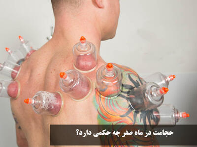 حجامت در ماه صفر چه حکمی دارد؟ خوب است یا بد؟