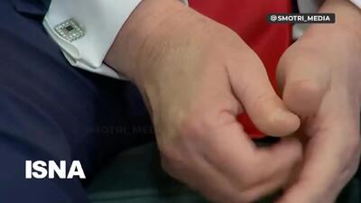 ببینید| علایم روی دست ترامپ بیماری او را لو داد