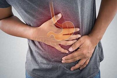 یک‌سوم ایرانی‌ها رفلاکس معده دارند