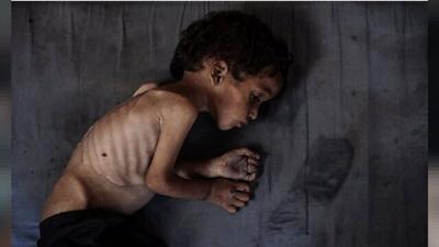 بیش از ۴۰ هزار نوزاد فلسطینی در معرض خطر مرگ تدریجی هستند