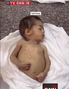 شهادت جانسوز نوزاد فلسطینی در اثر گرسنگی
