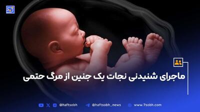 ماجرای شنیدنی نجات یک جنین از مرگ حتمی