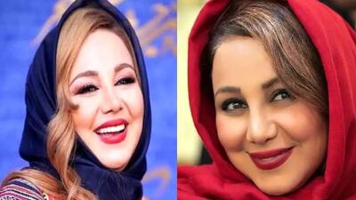 تصویر روز | بهنوش بختیاری با رنگ موهای عجیب که سوژه مجازی شد! | گلی شی