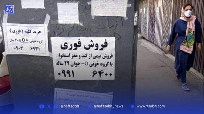 فروش‌ کلیه تا‌ ۷۰ میلیارد‌ تومان
