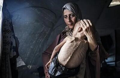 کودکان غزه در حال تمام شدن هستند!