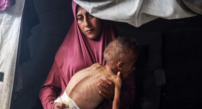کودک ۱۰ ساله فلسطینی، هم‌وزن نوزاد ۱۲ ماهه! | جهان نیوز