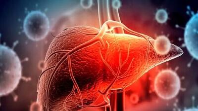 آیا سرطان کبد به قاتل 1/5 میلیون نفر تا سال 2050 تبدیل می‌ شود؟