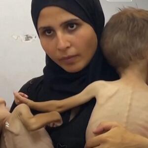 غزه؛ دست خالی مادران و پزشکان برابر گرسنگی و بیماری کودکان
