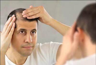 خوراکی‌های مفید برای سلامت و رشد مو