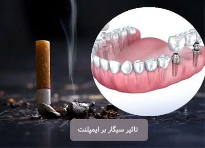 چند روز بعد از ایمپلنت می‌توانم سیگار بکشم؟