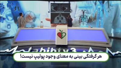 بررسی گرفتگی‌های بینی و ارتباط آنها با پولیپ + فیلم