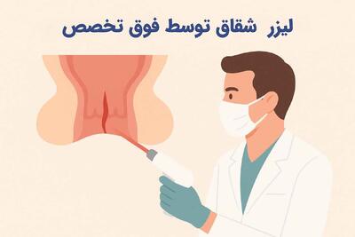 همه چیز در مورد لیزر شقاق