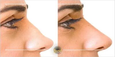 نوک بینی‌تان را بدون تغییرات گسترده اصلاح کنید - چی بپوشم