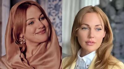 تصویر روز | چهره تازه مریم اوزرلی بدون آرایش و بعد از تزریق ژل و بوتاکس | گلی شی
