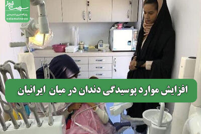 افزایش موارد پوسیدگی دندان در میان  ایرانیان