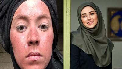 تصویر روز | چهره نیلوفر رجایی فر در 32 سالگی | گلی شی