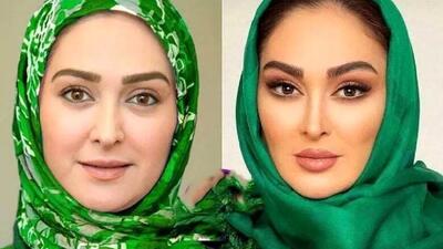 تصویر روز | چهره الهام حمیدی قبل معروف شدنش | گلی شی