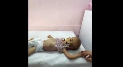 شهادت نوزاد ۱ ساله فلسطینی بر اثر گرسنگی شدید | جهان نیوز