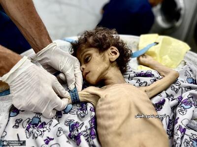 شهادت کودک فلسطینی بر اثر گرسنگی در جنوب غزه + عکس ها