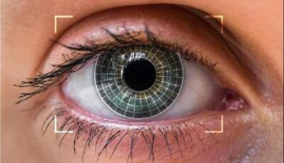 تغییر رنگ چشم؛ یک جراحی زیبایی پرطرفدار / توصیه یک چشم‌پزشک به متقاضیان