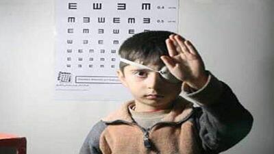 شناسایی بیش از ۶۳ هزار اختلال بینایی در کودکان