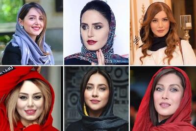 هنرمندان ایرانی بدون جراحی زیبایی