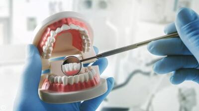 لمینت و کامپوزیت برای همه مناسب نیست /  طرح لبخند  واژه ای که به غلط در جامعه در حال تبلیغ است