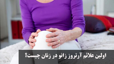 اولین علائم آرتروز زانو در زنان چیست؟ برای آرتروز زانو چی خوبه؟ 