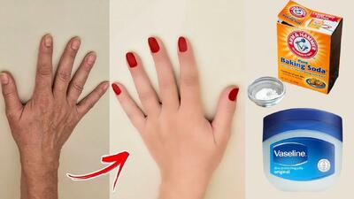 روش طبیعی برای سفید کردن نواحی تیره بدن / سفید ،بدون چروک، صاف و جوان تر